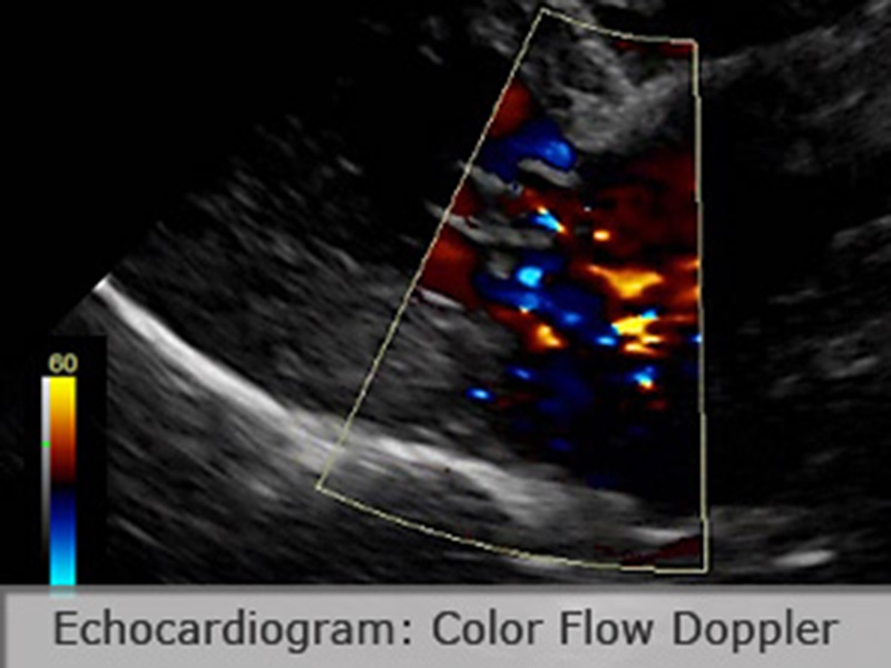 Echocardiography Ultrasound For Dogs Kansas City